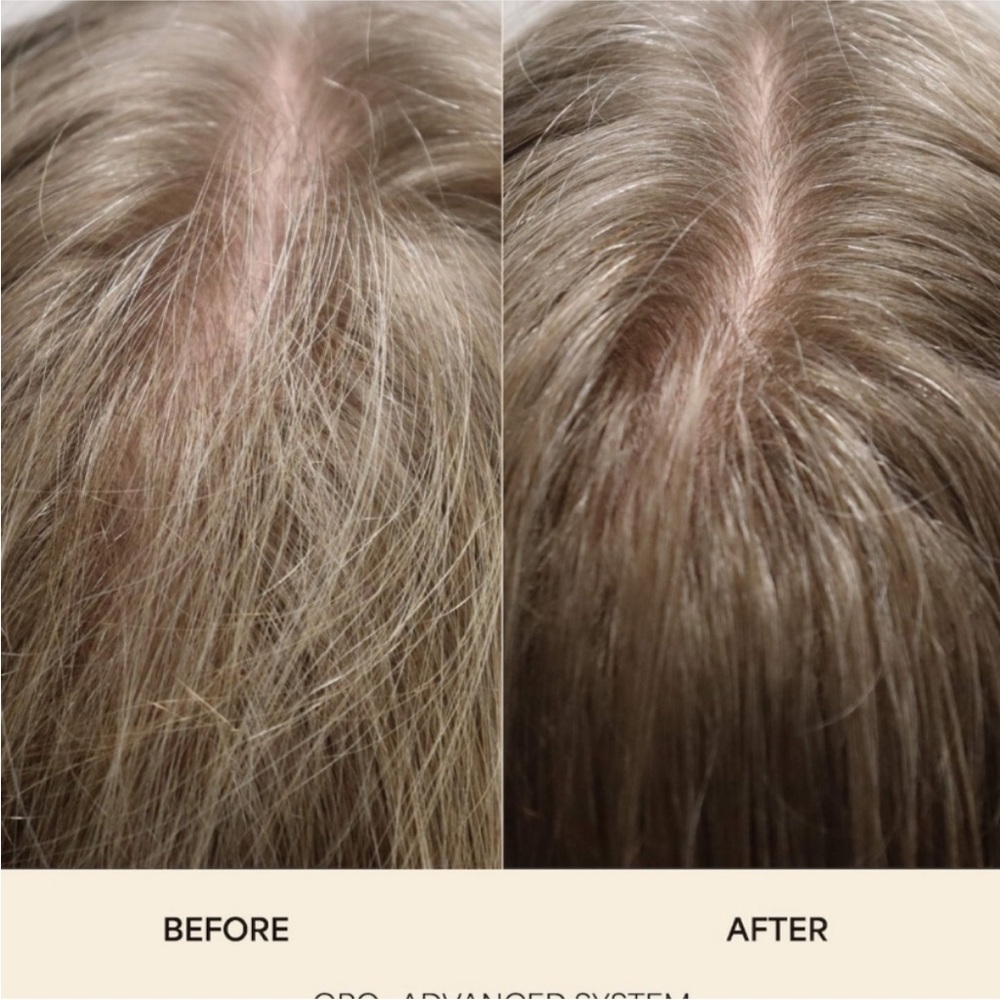 NIB VEGAMOUR GRO ADVANCED HAIR GROWTH SYSTEM - Picture 6 of 10